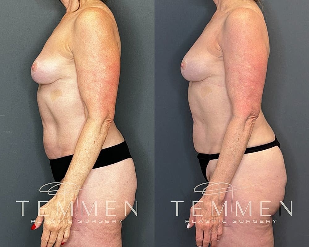 Before and after body transformation photos.