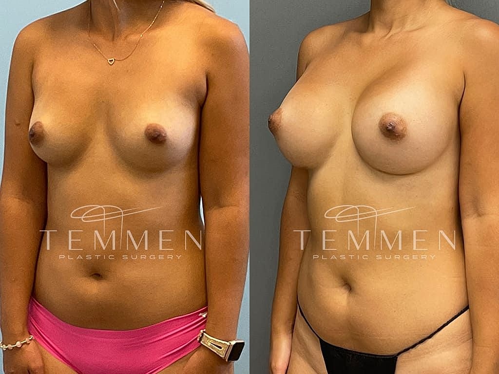 Before and after plastic surgery transformation photo.