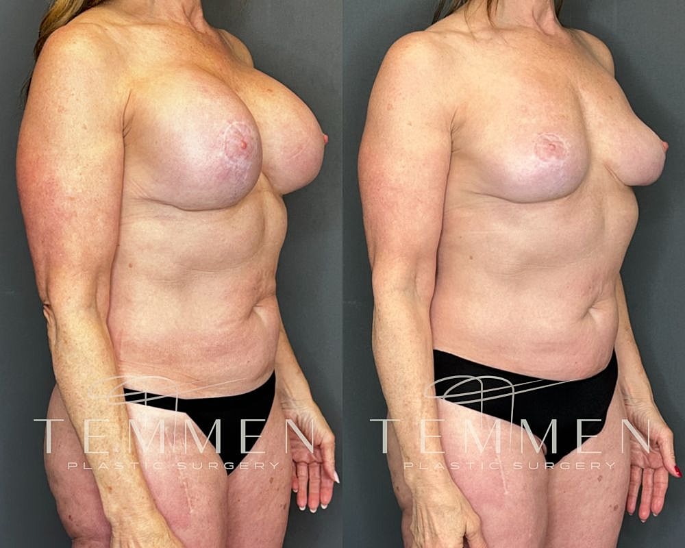 Before and after plastic surgery transformation photos.