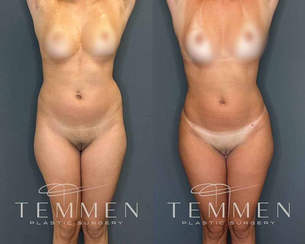 Before and after plastic surgery transformation comparison.