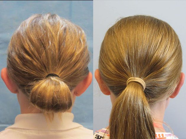 Ear Surgery Before & After