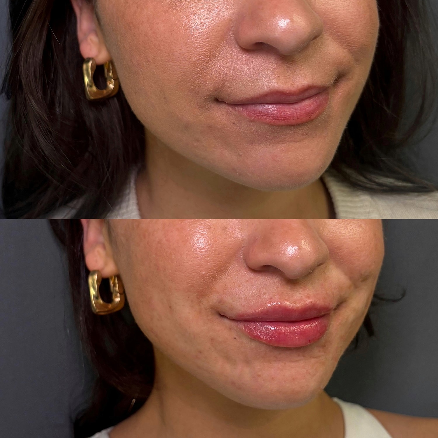 Comparison of lip gloss application results.